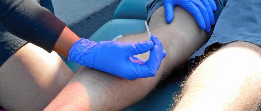 Trigger Point Dry Needling